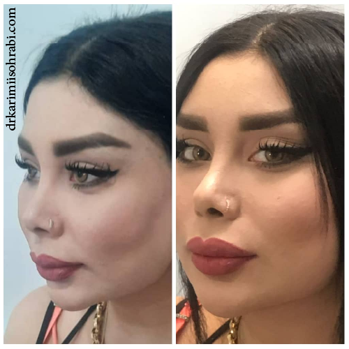 کلینیک کریمی خدمات بوتاکس چربی صورت در تهران ولیعصر